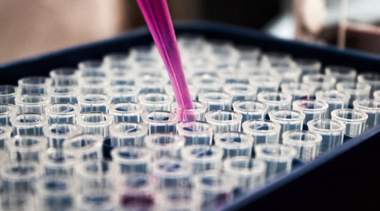 Test tubes in a lab